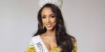 Miss Jamaica, Dr. Gabrielle Henry, mengalami pendarahan intrakranial